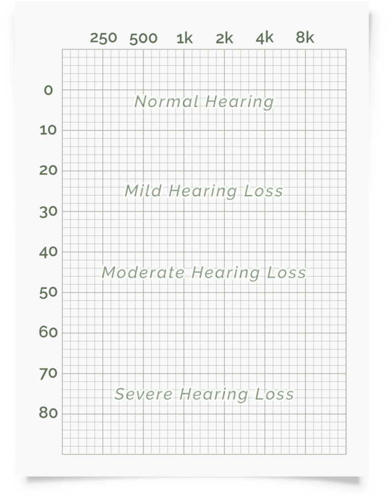 Blank Audiogram Template Download - Professional Template